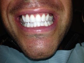 photo-21