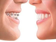 invisalign dentist dtla los angeles