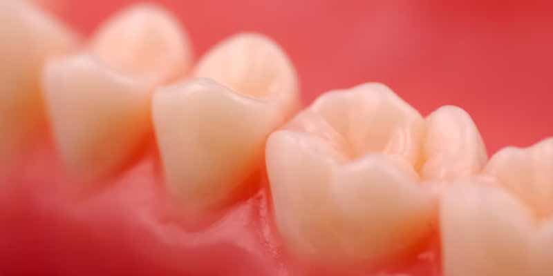 Gum Desease and Gingivitis Treatment in Los Angeles