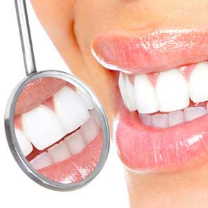 dentail cleaning in downtown los angeles dentist