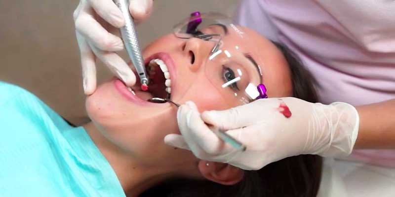 teeth cleaning in downtown los angeles