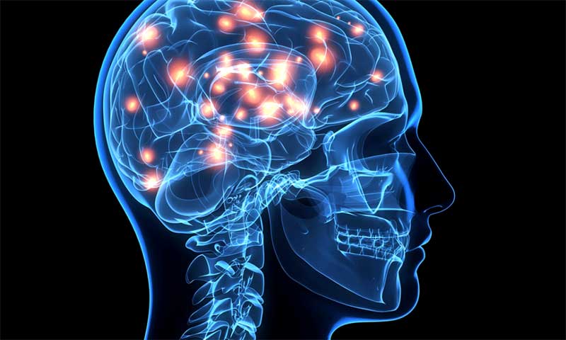 brain disease (alzheimers) and gum disease (periodontitis) deep cleaning